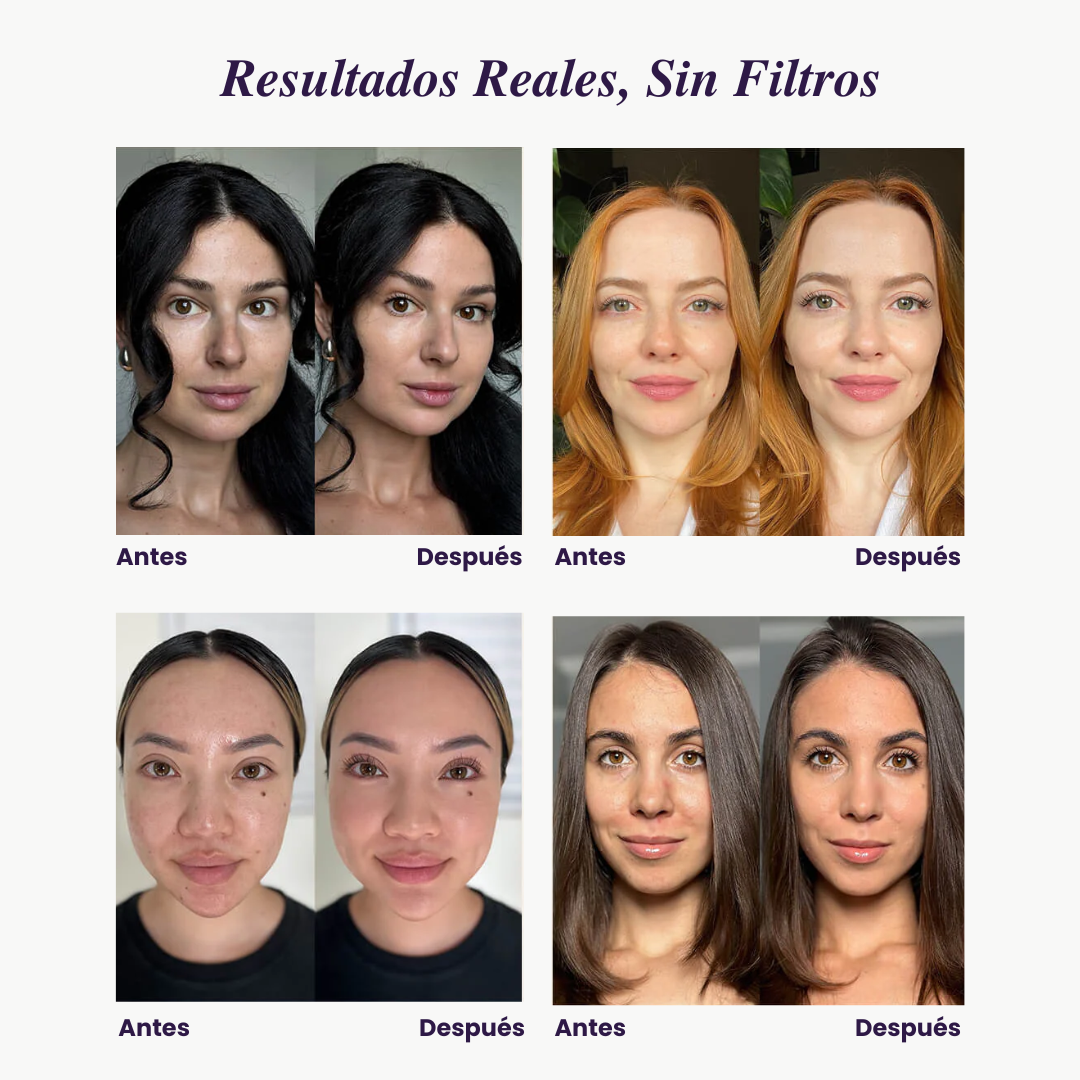 Reductor de puntos negros - Piel sin manchas